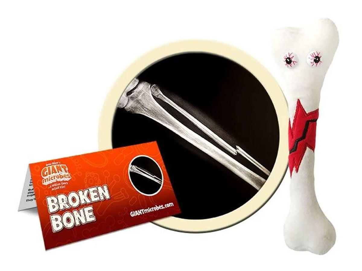 GIANTmicrobes Broken Bone