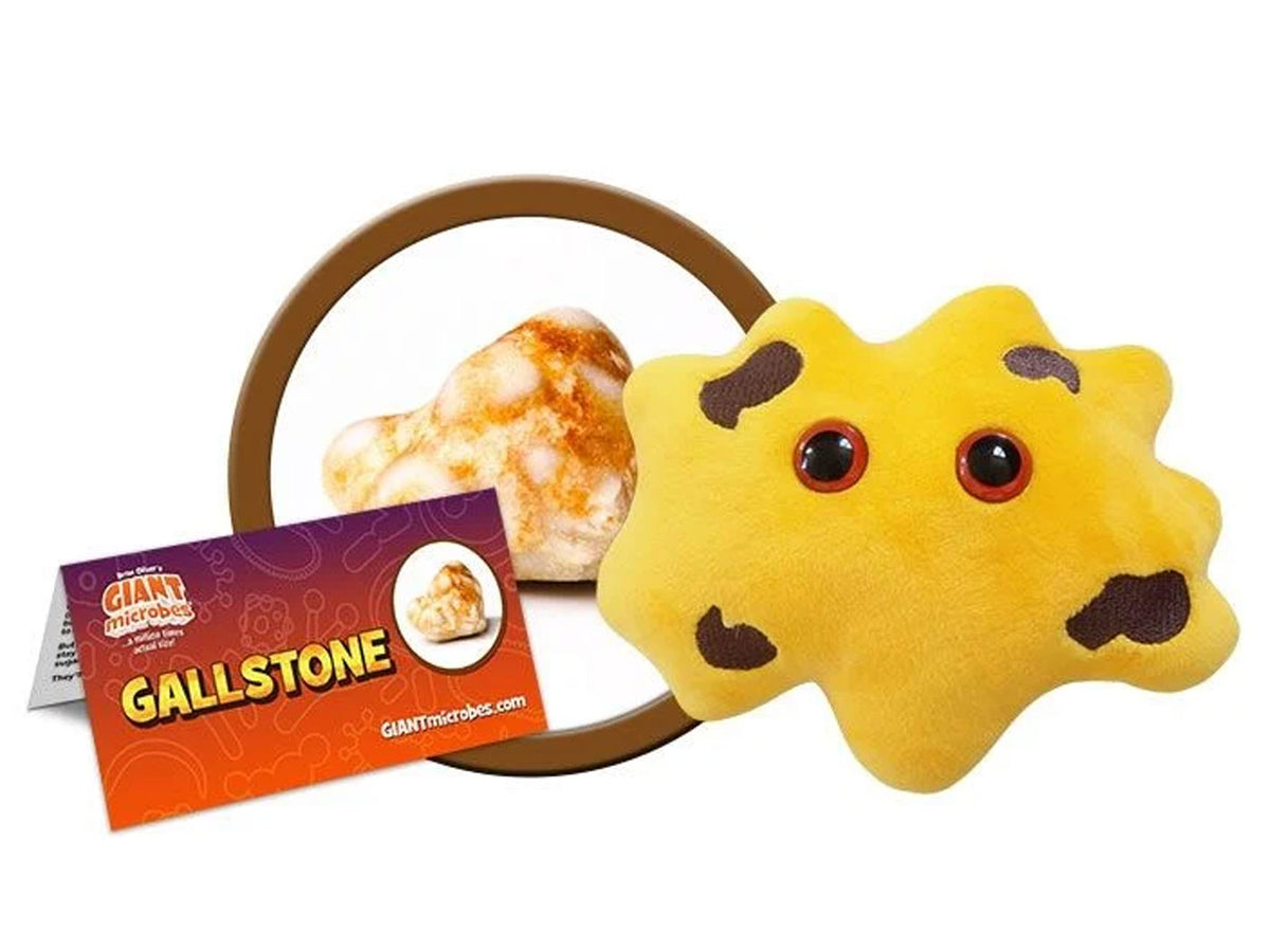 GIANTmicrobes Gallstone